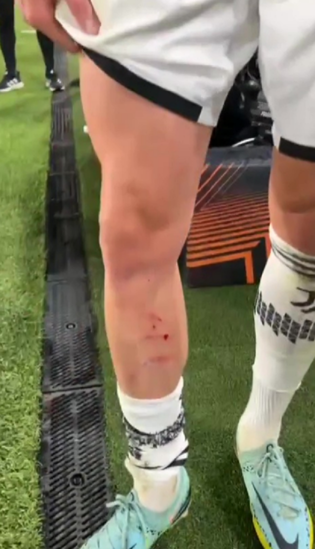 Phản pháo trọng tài, sao Juve đưa ra “bằng chứng thép”_6928445c45d28.png