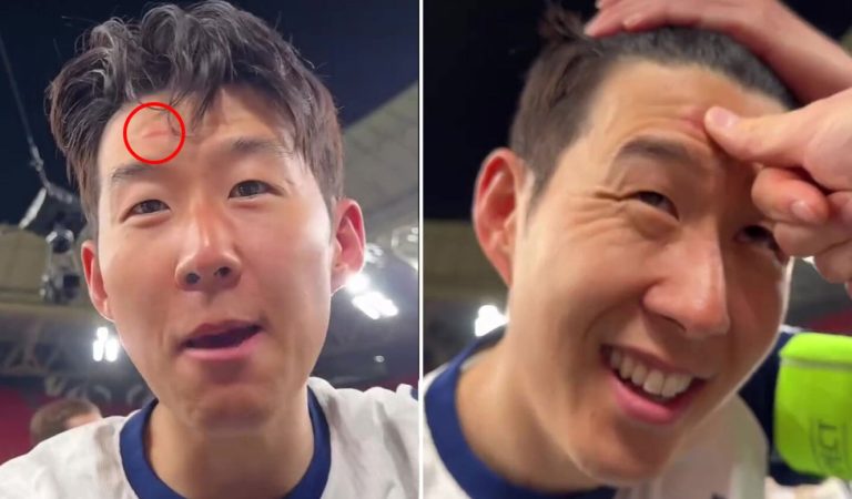 Son Heung-min gặp sự cố khi ăn mừng chức vô địch Europa League_692835db93d11.jpeg